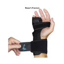 MedSpec Boxer Splint II - Left-Ulnar / Right-Radial product image