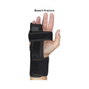 MedSpec Boxer Splint II - Left-Ulnar / Right-Radial product image