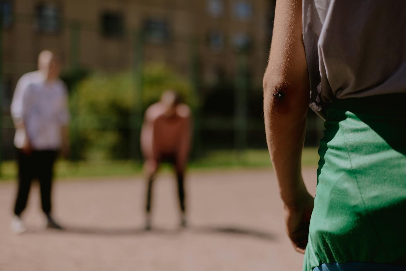 Close-up of an elbow injury during sport